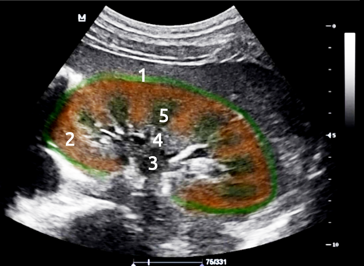 Ультразвуковая диагностика заболеваний почек,мочевого пузыря и предстательной железы