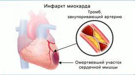 Урок «Предупреждение заболеваний сердца и сосудов»