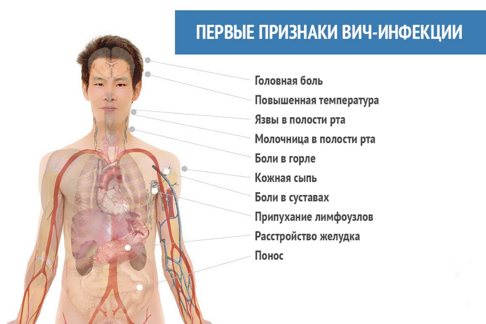 Внекласное мероприятие на тему: 1 декабря - Всемирный день борьбы со СПИДом