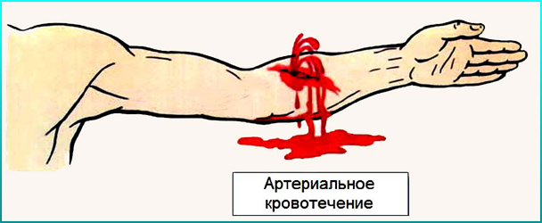 Урок на тему кровотечения