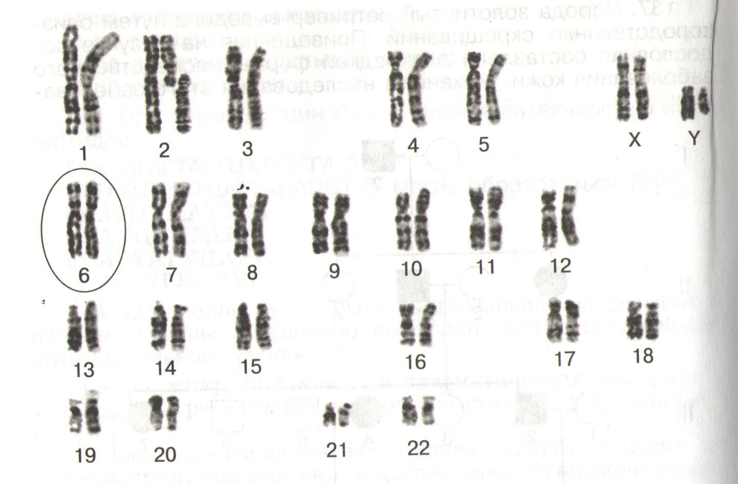 У шимпанзе в соматических клетках 48. Кариотип шимпанзе. Кариотип человека гаметогенез. Набор хромосом шимпанзе. Кариотип в митозе.