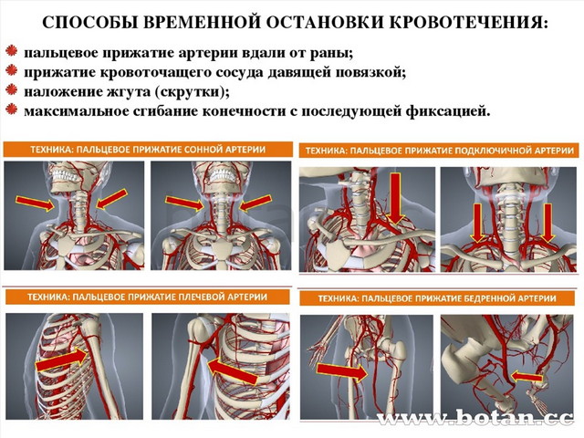 Пмп при кровотечениях презентация