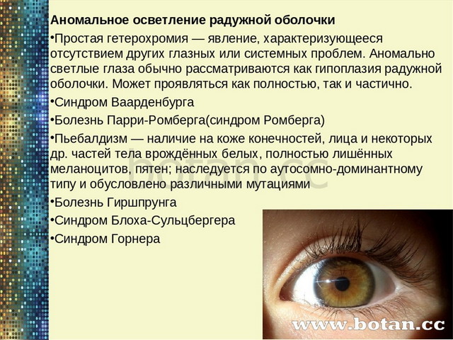 Аномальное осветление радужной оболочки. Гетерохромия у человека презентация. Гетерохромия в генетике. Наследование гетерохромии. Аномальное осветление радужной оболочки. Гетерохромия у человека презентация. Гетерохромия в генетике. Наследование гетерохромии.